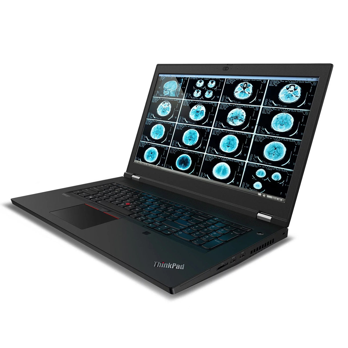 P17 300 Lenovo nits, i7-10750H, 1TB IPS ThinkPad Laptop, FHD 32GB, Quadro, 17.3"