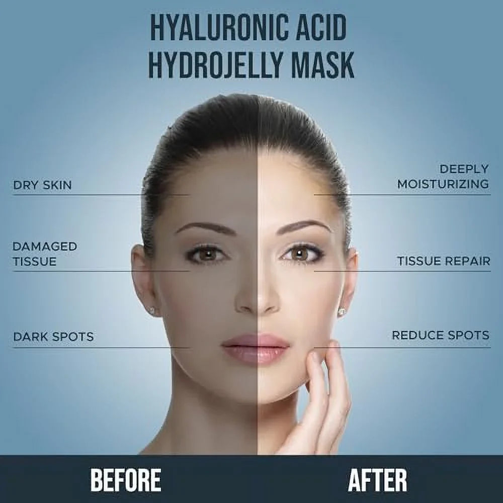 Pack Hyaluronic - Facial Spot Anti-Aging, off Skin & All Mask, Suitable Mask Jelly Reducing 30 Dark Types Natural Skin Lab Treatment Acid Professional Skin | - for Peel oz Luminous fl