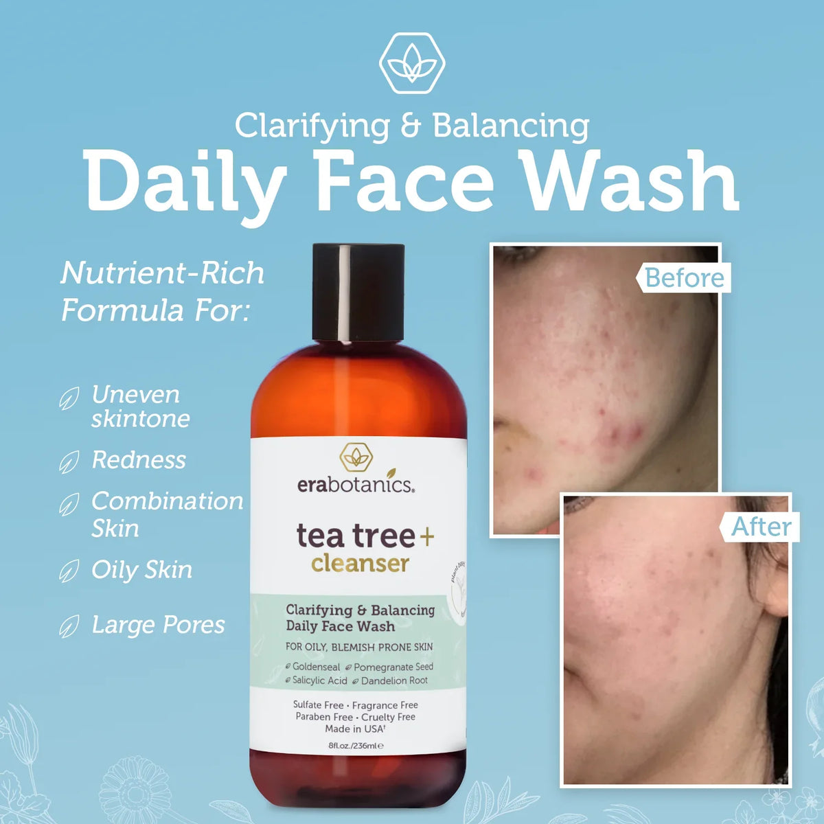 8oz Cleanser Era Organics and Tree Oil Tea Wash Body Face